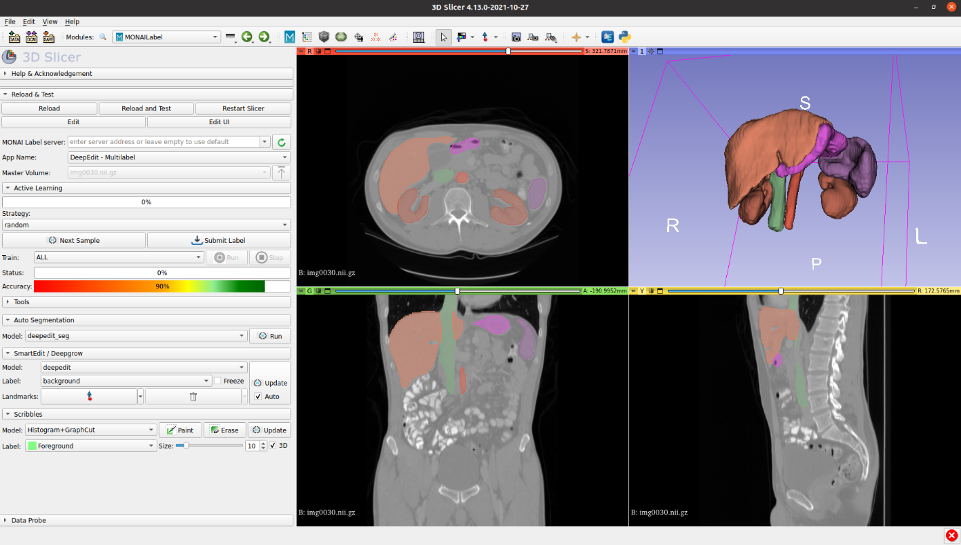 MONAI Label for Medical Imaging